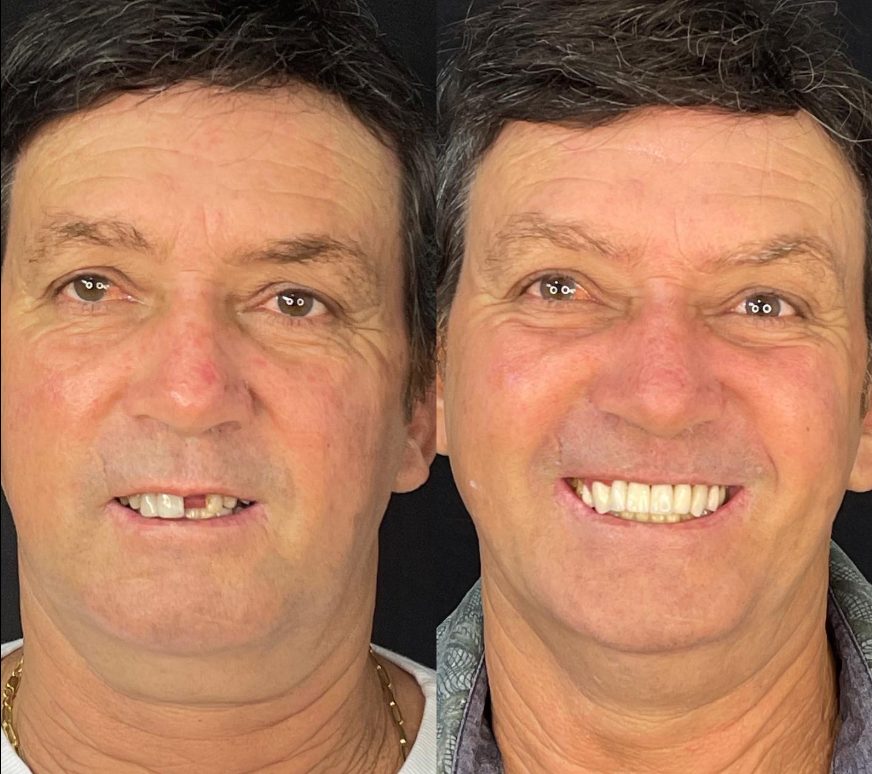 Resultado Odontológico 3