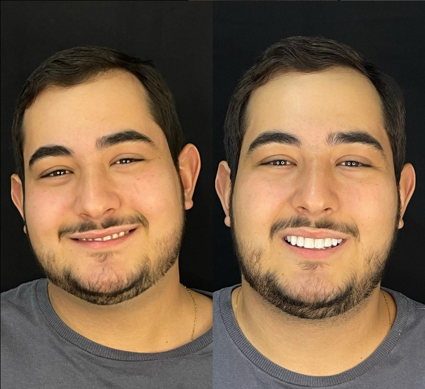 Resultado Odontológico 1